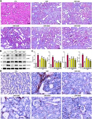 Shenkang Injection and Its Three Anthraquinones Ameliorates Renal Fibrosis by Simultaneous Targeting IƙB/NF-ƙB and Keap1/Nrf2 Signaling Pathways